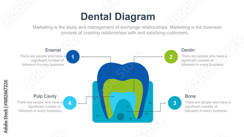 Dental Diagram Overview of Dental Procedures
