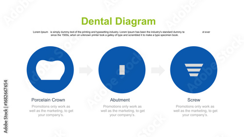 Dental Diagram Overview of Dental Procedures