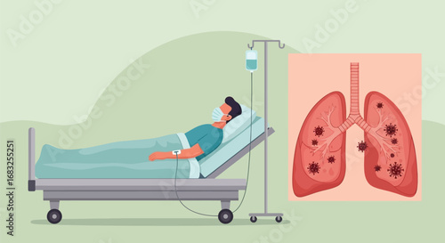 Patient in Hospital Bed with Lung Disease, Medical Illustration of Affected Lungs