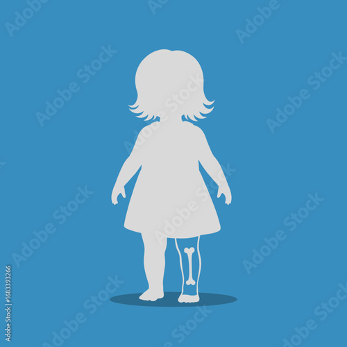 Understanding pediatric orthopedic care for young children with bone health concerns and mobility challenges