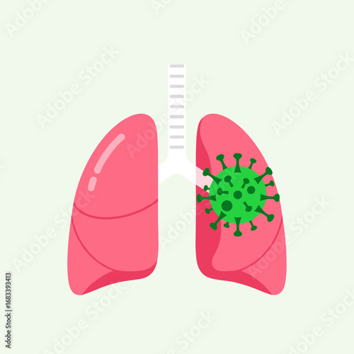 Illustration of a virus impacting the human respiratory system with focus on lung damage and infection spread within the pulmonary organ