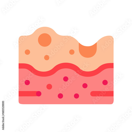 Sectional flat illustration of epidermis and dermis skin layers