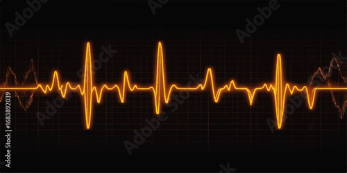 A continuous electrocardiogram (ECG) wave shows a steady heartbeat on a medical monitor