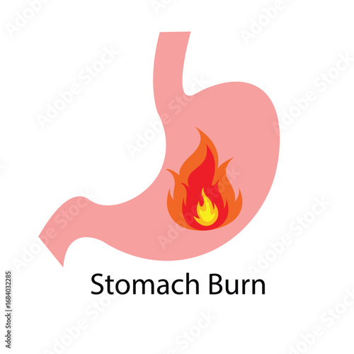 Stomach Burn vector icon. A medical illustration of a stomach with fire, symbolizing heartburn, acid reflux, and indigestion. Isolated on a white background.