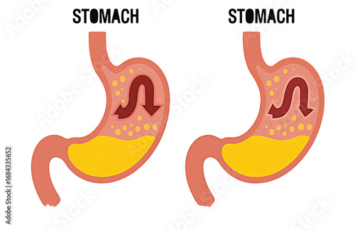 Anatomical diagram of human stomach function with peristalsis and churning motion of food and acid for science education