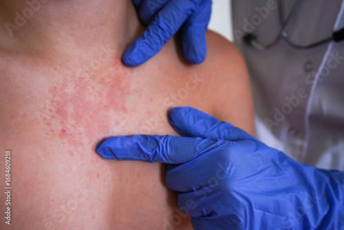 The physician is inspecting the child's skin for signs of monkeypox.