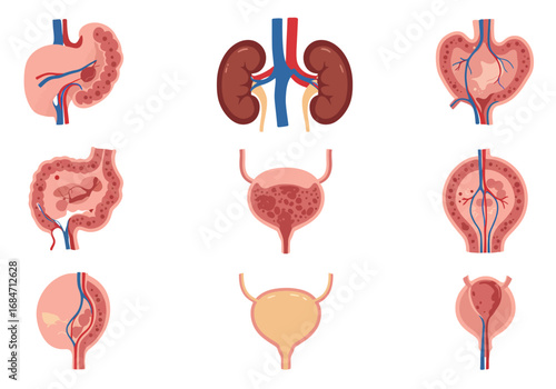 Nine diagrams illustrating human organs in varying states of health arranged in a 3x3 grid