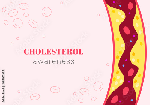 Cholesterol. Artery blocked with cholesterol, blood pressure, arteriosclerosis