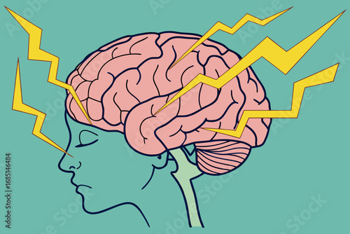 Vector illustration of human brain with lightning bolts symbolizing migraine
