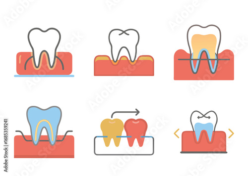 Six schematic illustrations of tooth and gum conditions, highlighting different dental issues