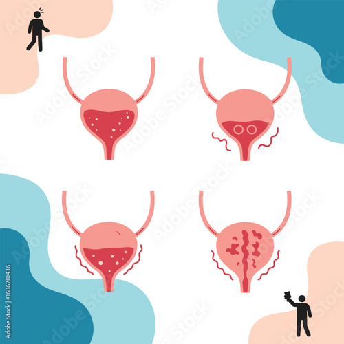 Medical illustration of bladder health and diseases, ideal for healthcare and educational content