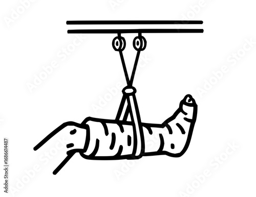 Suspended Arm in Cast