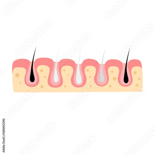 hair loss, alopecia concept. vector illustration