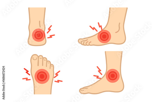Foot and ankle pain points diagram vector set. Medical education illustration. Heel, sole, instep ache. Anatomy infographic. Sprain, injury, inflammation, arthritis concept.