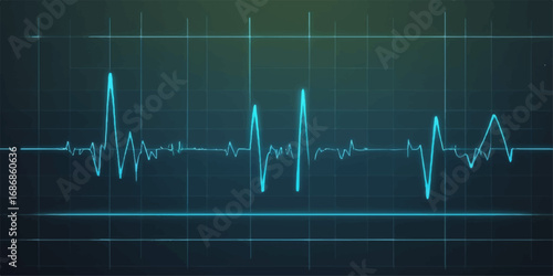 Electrocardiogram graph showing a heartbeat on a medical monitor