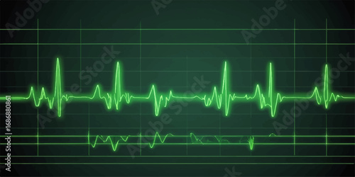 Blue EKG waves illustrate a healthy heartbeat on a medical screen