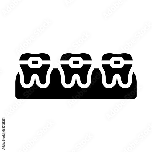 Braces
