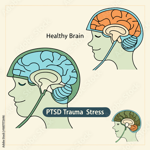 Brain Comparison Healthy vs