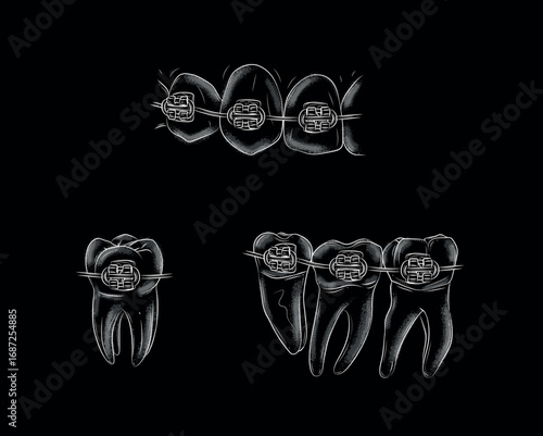 Teeth with braces set illustration drawing in graphic style with white on black background.