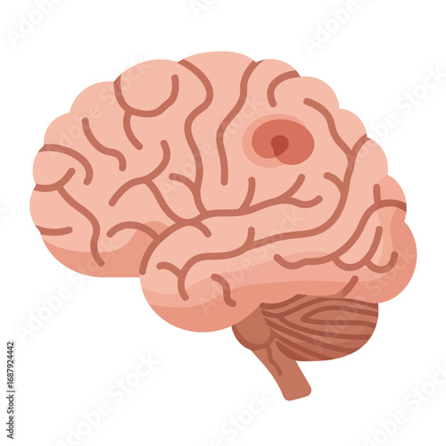 brain damage illustration showing tumor growth for medical education content and healthcare awareness campaign materials