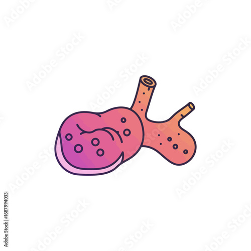 thyroid gland with nodule in detailed anatomical illustration of endocrine system a medical health concept