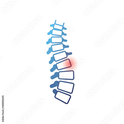 spinal pain illustration depicting vertebral injury in a medical diagram showing backache and spinal problem for health education