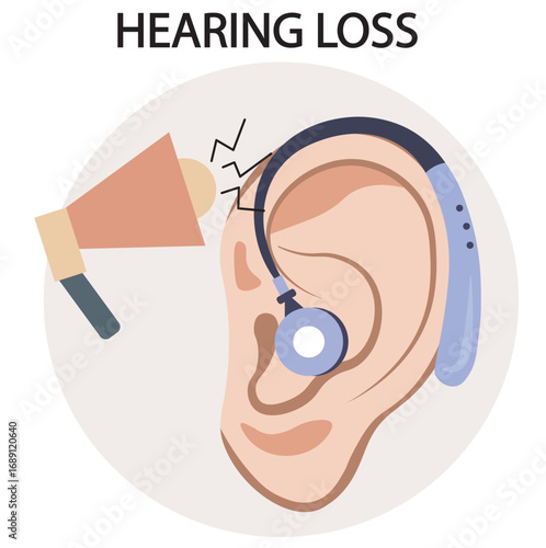 Vector illustration of hearing loss showing muffled sounds, tinnitus, ear pain, and balance issues, with related conditions like otitis media, presbycusis, and acoustic trauma speaker ear phone
