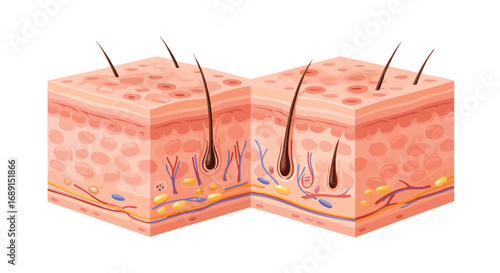 Illustration of skin layers with hair follicles, sebaceous glands, and blood vessels, showing a cross-section of healthy skin.