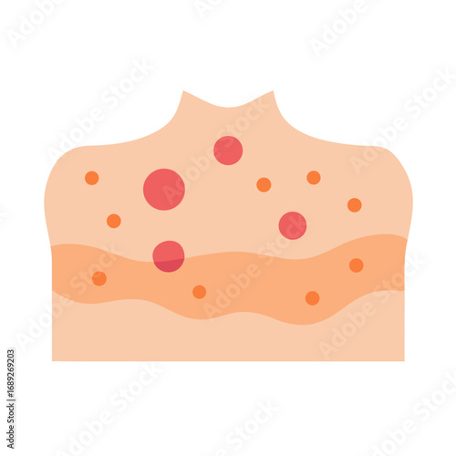 Illustration of skin with visible skin condition or allergy
