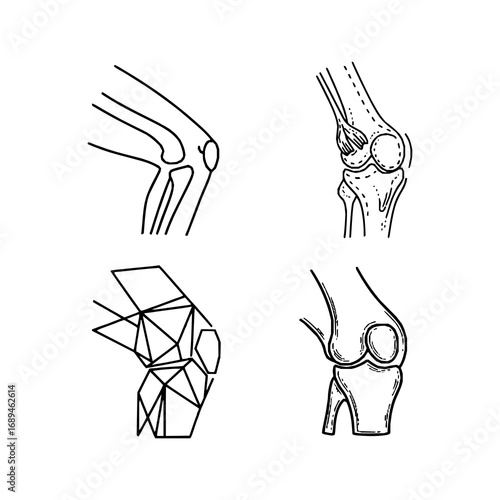 Four simple black line drawings of a human knee joint in different views. The illustrations show front