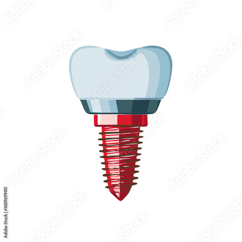 Dental implant illustration showing a white tooth crown and red threaded post