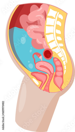 Ascites 