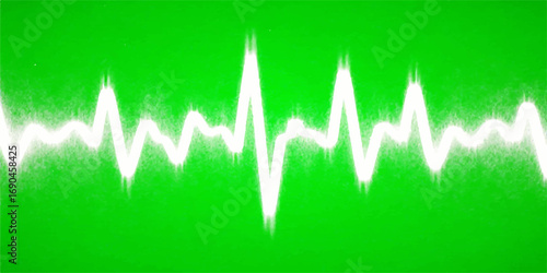 Abstract medical graphic of a pulsing heartbeat on a green background