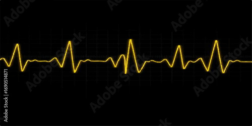 A healthy heartbeat pulse is displayed on a green monitor's medical chart