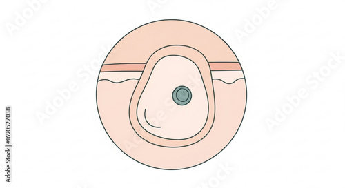 Understanding ostomy care and stoma appliance systems for bowel management and skin protection guide tips