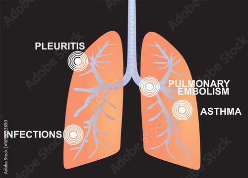 Lungs pain disorders. vector illustration	