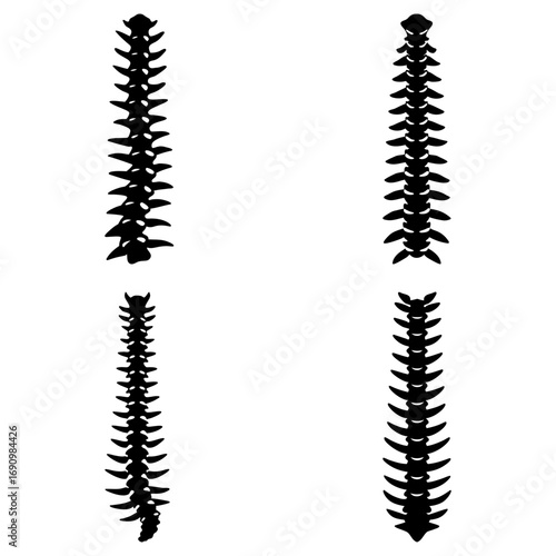 Four spinal column illustrations in black and white showing vertebral alignment and anatomical structure clearly