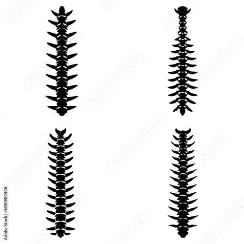 Four anatomical spine illustrations showing different spinal structures in a vertical arrangement on white
