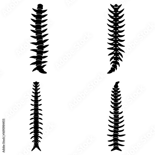 Four spine silhouettes arranged in a square format on a white background showing anatomical structures