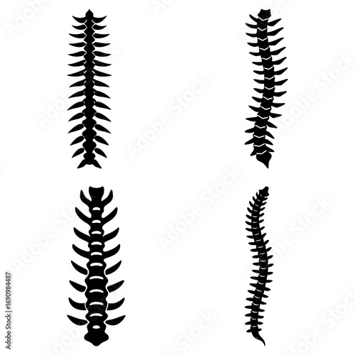 Illustration showing four different views of a spine with varying curvatures and orientations in black