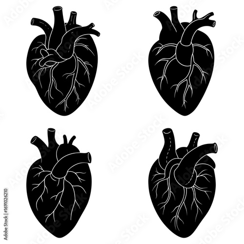 Four heart illustrations in black and white showing anatomical details and vessel structures clearly visible