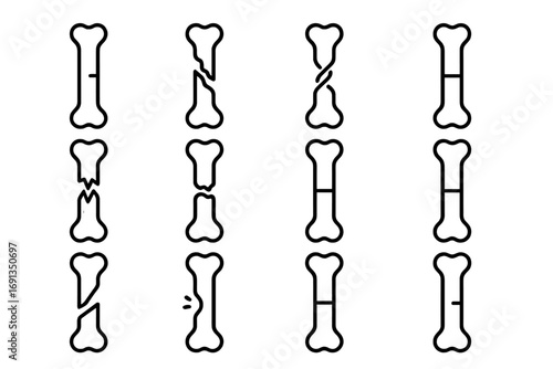 Fracture Types Icons. Outline icon set of fracture types: simple fracture, compound fracture, spiral fracture,