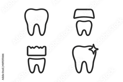 Dental crown icon set. Tooth restoration process. Dental implant, veneer concepts. Dentistry line art pictograms. Stomatology, oral hygiene, healthy clean tooth, whitening vector symbols.