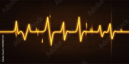 Medical heart pulse wave on a monitor, an EKG heartbeat graph in green and black