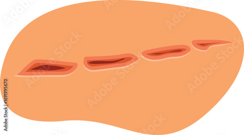 Realistic illustration of a deep skin cut showing muscle tissue, ideal for medical and healthcare publications