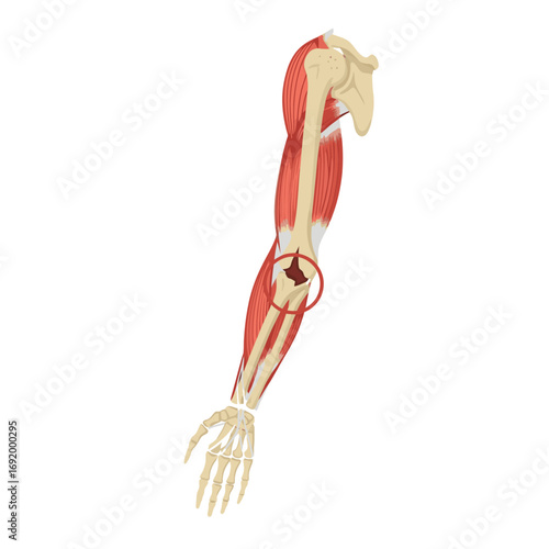 Detailed Anatomical Illustration of the Human Arm Showing Elbow Joint Pain and Musculoskeletal Structure