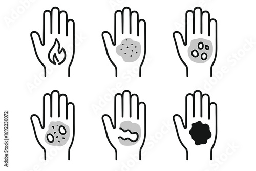 Illustration of six hand conditions: burn, rash, spots, wounds, bumps, blotch