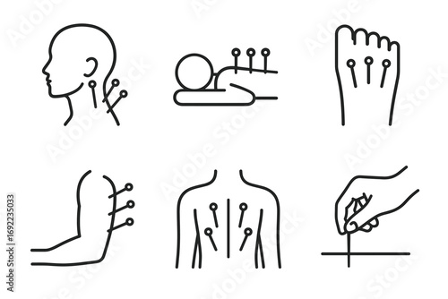 Acupuncture therapy: needle placement for pain relief and relaxation