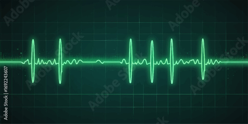 Medical heart pulse on a cardiogram chart