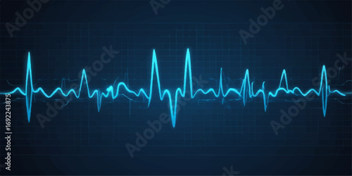 Medical graph showing a green electrocardiogram heartbeat pulse line on a black monitor screen with a cardio illustration